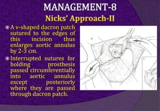  A v-shaped dacron patch
sutured to the edges of
this incision thus
enlarges aortic annulus
by 2-3 cm.
 Interrupted sutures for
holding prosthesis
passed circumferentially
into aortic annulus
except posteriorly
where they are passed
through dacron patch.
 