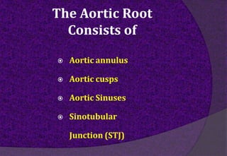  Aortic annulus
 Aortic cusps
 Aortic Sinuses
 Sinotubular
Junction (STJ)
The Aortic Root
Consists of
 