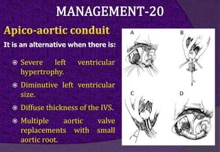 It is an alternative when there is:
 Severe left ventricular
hypertrophy.
 Diminutive left ventricular
size.
 Diffuse thickness of the IVS.
 Multiple aortic valve
replacements with small
aortic root.
 