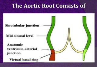 The Aortic Root Consists of
 