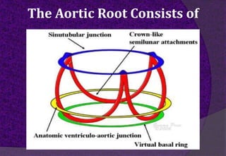 The Aortic Root Consists of
 