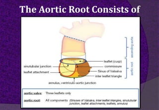 The Aortic Root Consists of
 