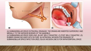 Infected Incision Example Red MANAGEMENT OF SPACE INFECTION BY DR SHRUTI | PPTX