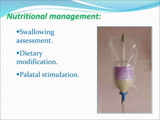Nutritional management:
Swallowing
assessment.
Dietary
modification.
Palatal stimulation.
 