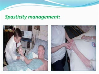 Spasticity management:
 