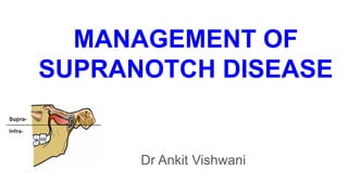 MANAGEMENT OF
SUPRANOTCH DISEASE
Dr Ankit Vishwani
 