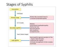 Stages of Syphilis
 
