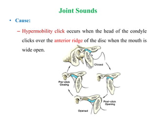 Management of temporomandibular disorders | PPTX