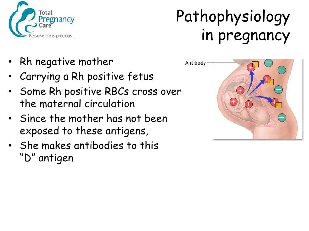 Management of the Rhesus Negative Mother