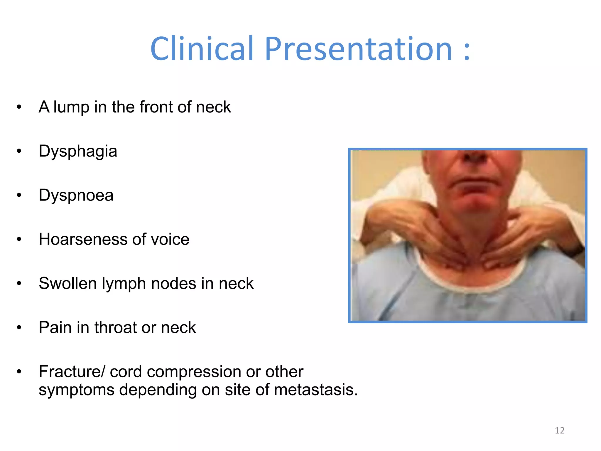 Management of thyroid cancer | PPTX