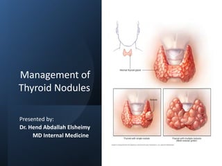 Management of
Thyroid Nodules
Presented by:
Dr. Hend Abdallah Elsheimy
MD Internal Medicine
 