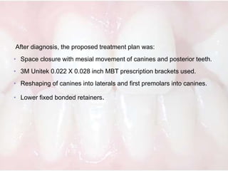 Management of tooth agenesis in orthodontics