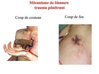 Management of trauma   french dr. nahla
