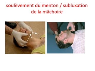 Management of trauma   french dr. nahla