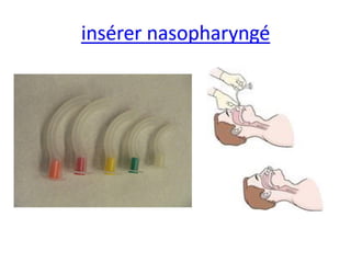 Management of trauma   french dr. nahla