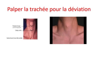 Management of trauma   french dr. nahla