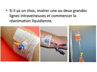 Management of trauma   french dr. nahla