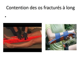 Management of trauma   french dr. nahla