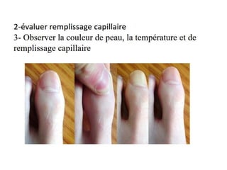 Management of trauma   french dr. nahla