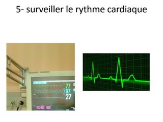 Management of trauma   french dr. nahla