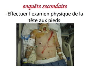 Management of trauma   french dr. nahla