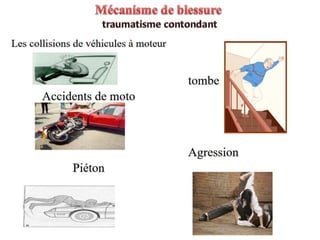 Management of trauma   french dr. nahla