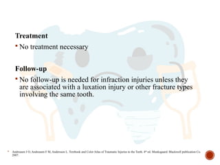 Infraction Tooth managementoftraumaticinjuryofprimarydentition.pptx