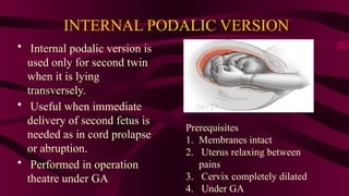 MANAGEMENT OF TWIN PREGNACY .pptx includes | PPTX