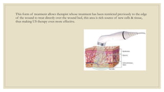 This form of treatment allows therapist whose treatment has been restricted previously to the edge
of the wound to treat directly over the wound bed, this area is rich source of new cells & tissue,
thus making US therapy even more effective.
 