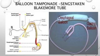 BALLOON TAMPONADE -SENGSTAKEN
BLAKEMORE TUBE
 