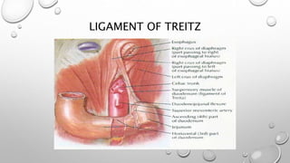 LIGAMENT OF TREITZ
 