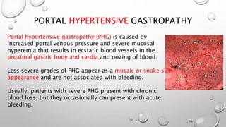 PORTAL HYPERTENSIVE GASTROPATHY
Portal hypertensive gastropathy (PHG) is caused by
increased portal venous pressure and severe mucosal
hyperemia that results in ecstatic blood vessels in the
proximal gastric body and cardia and oozing of blood.
Less severe grades of PHG appear as a mosaic or snake skin
appearance and are not associated with bleeding.
Usually, patients with severe PHG present with chronic
blood loss, but they occasionally can present with acute
bleeding.
 