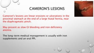 CAMERON'S LESIONS
Cameron's lesions are linear erosions or ulcerations in the
proximal stomach at the end of a large hiatal hernia, near
the diaphragmatic pinch.
May present as slow GI bleeding and iron deficiency
anemia.
The long-term medical management is usually with iron
supplements and an oral PPI.
 