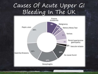 Causes Of Acute Upper GI
Bleeding In The UK
 