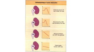 Urinary Obstruction Algorithm Management of upper urinary tract obstruction | PPTX