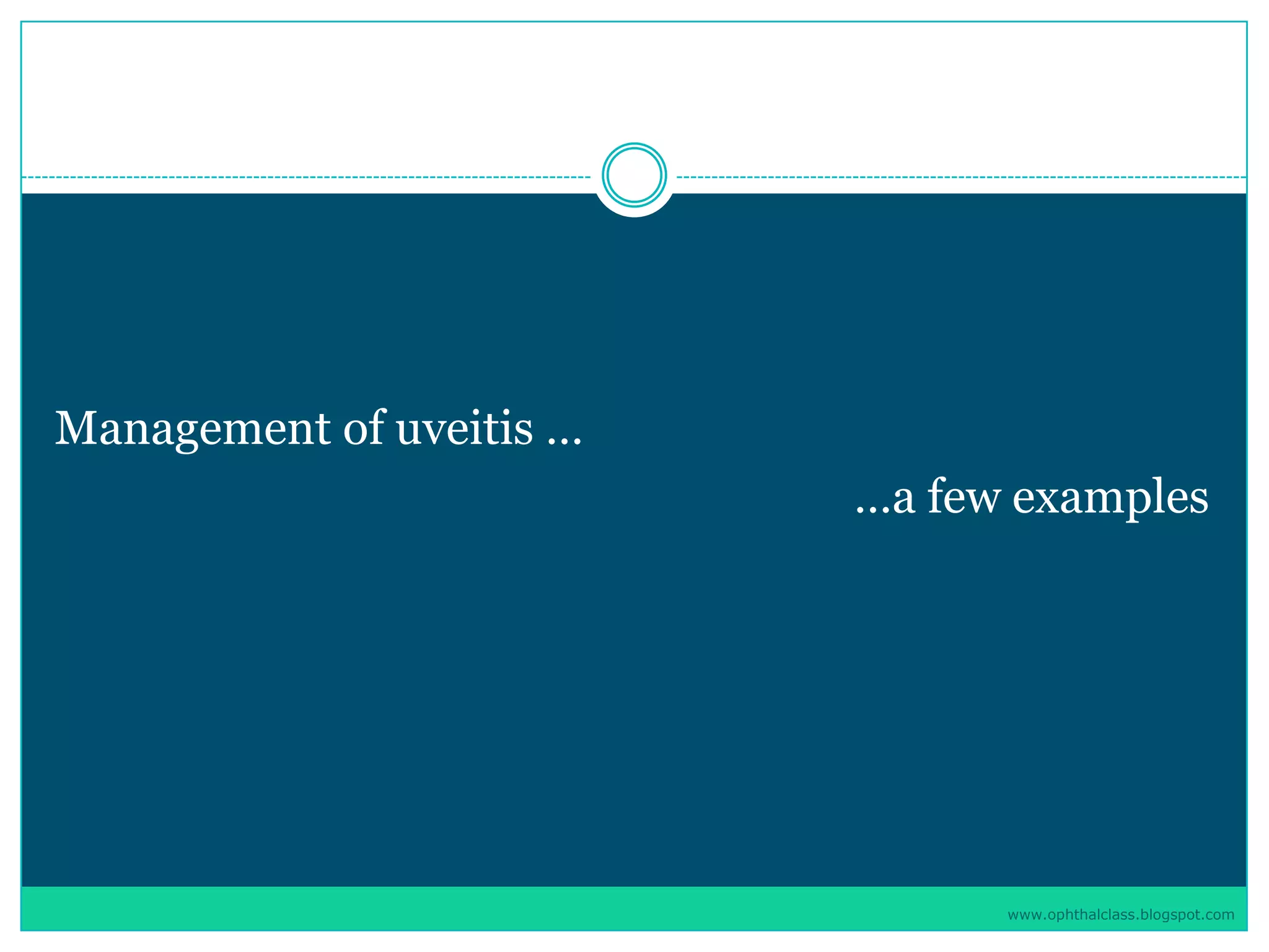 Management of uveitis