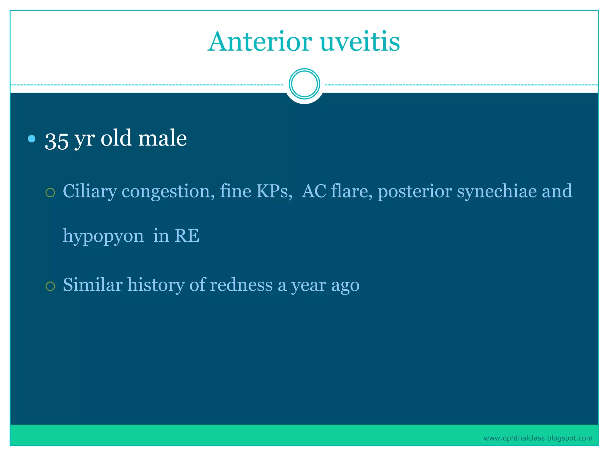 Management of uveitis