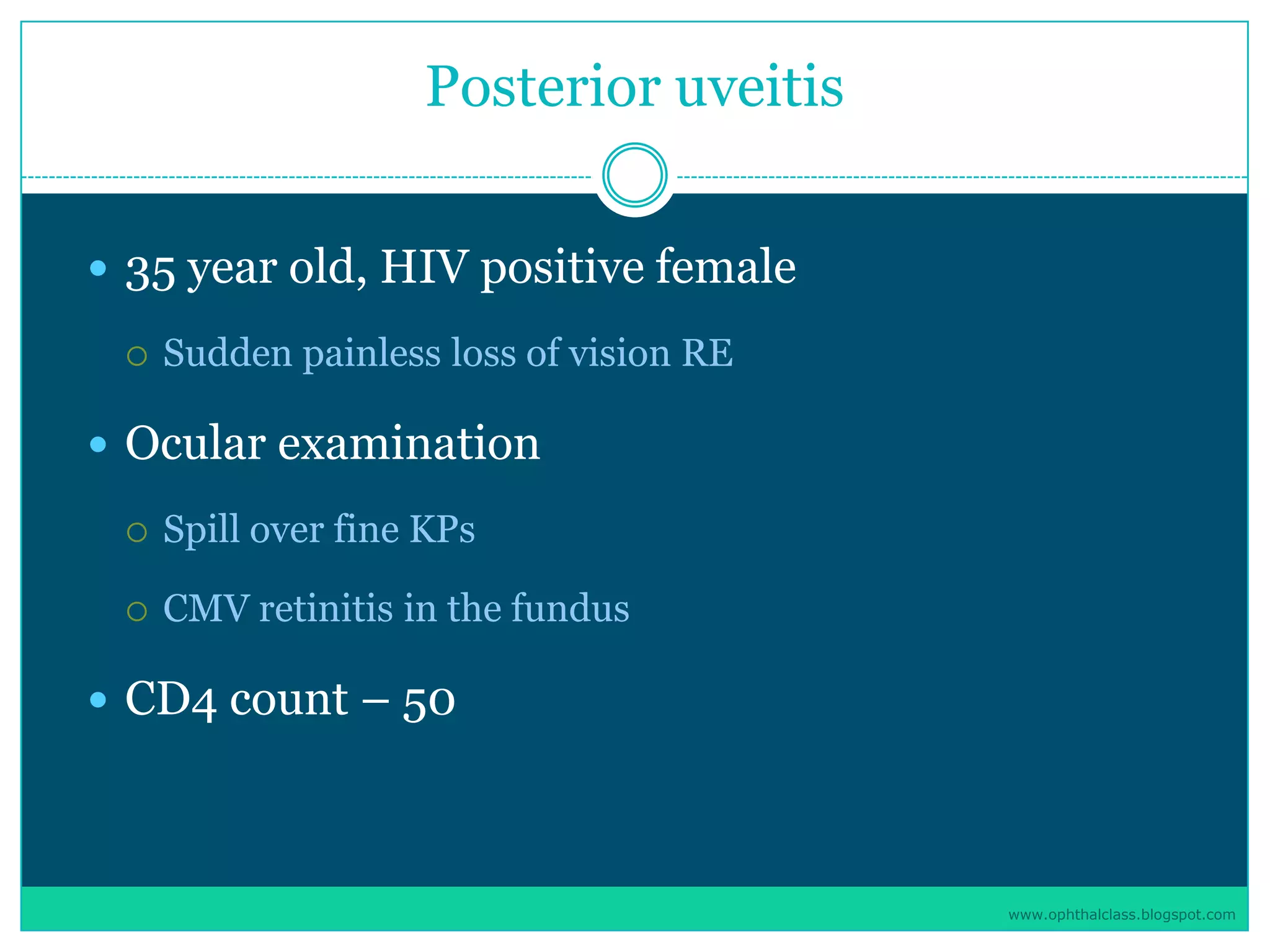 Management of uveitis