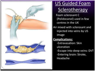 US Guided Foam
  Sclerotherapy
  Foam sclerosant C
   (Polidocanol) used in few
   centres in the UK
Air mixed with sclerosant and
   injected into veins by US
   image
Complications:
   -Extravasation: Skin
   ulceration
   -Escape into deep veins: DVT
   -Entering brain: Stroke,
   Headache
 