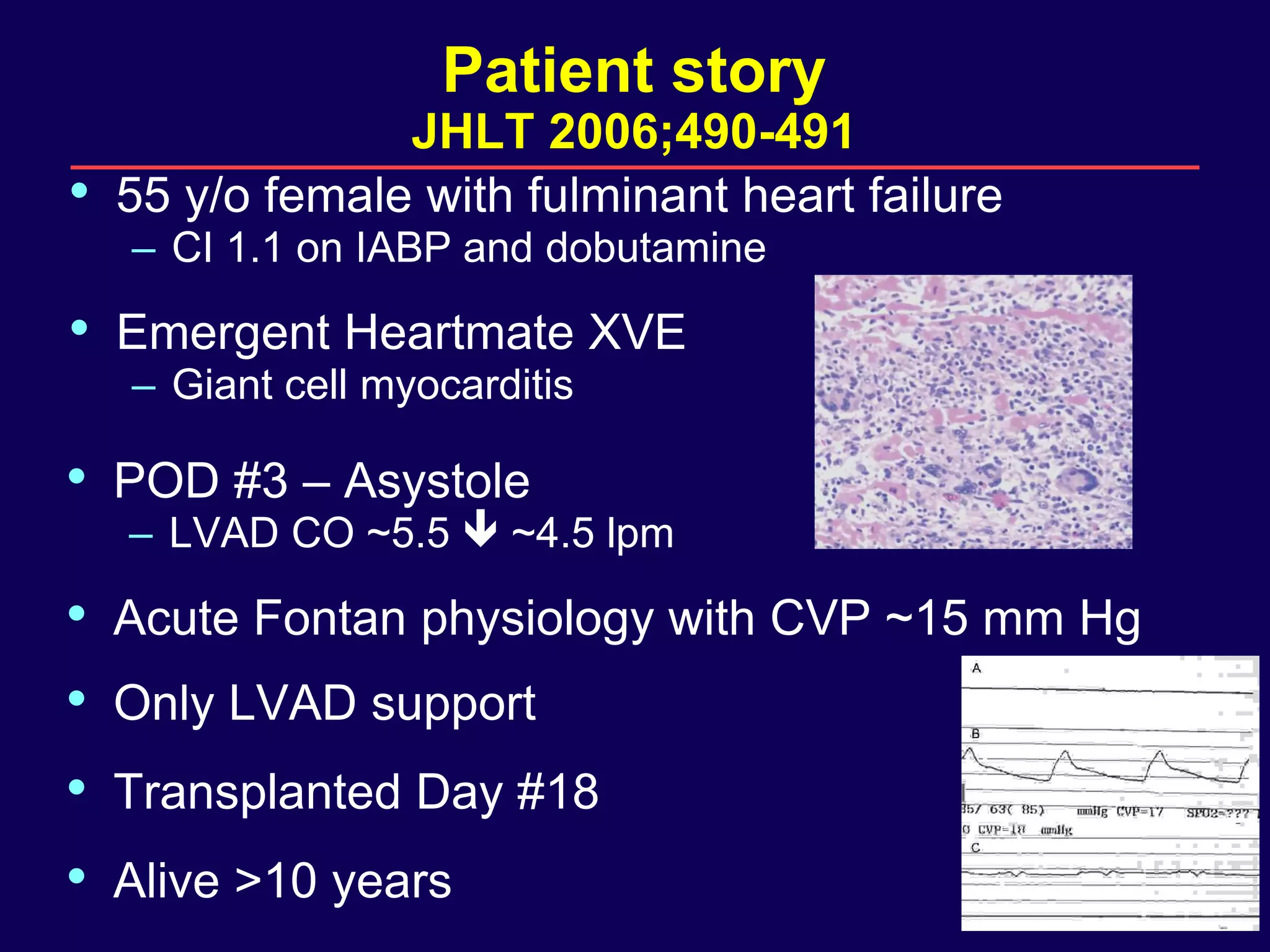 Management of ventricular tachycardia in advanced heart failure | PDF