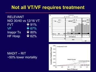 Management of ventricular tachycardia in advanced heart failure | PDF
