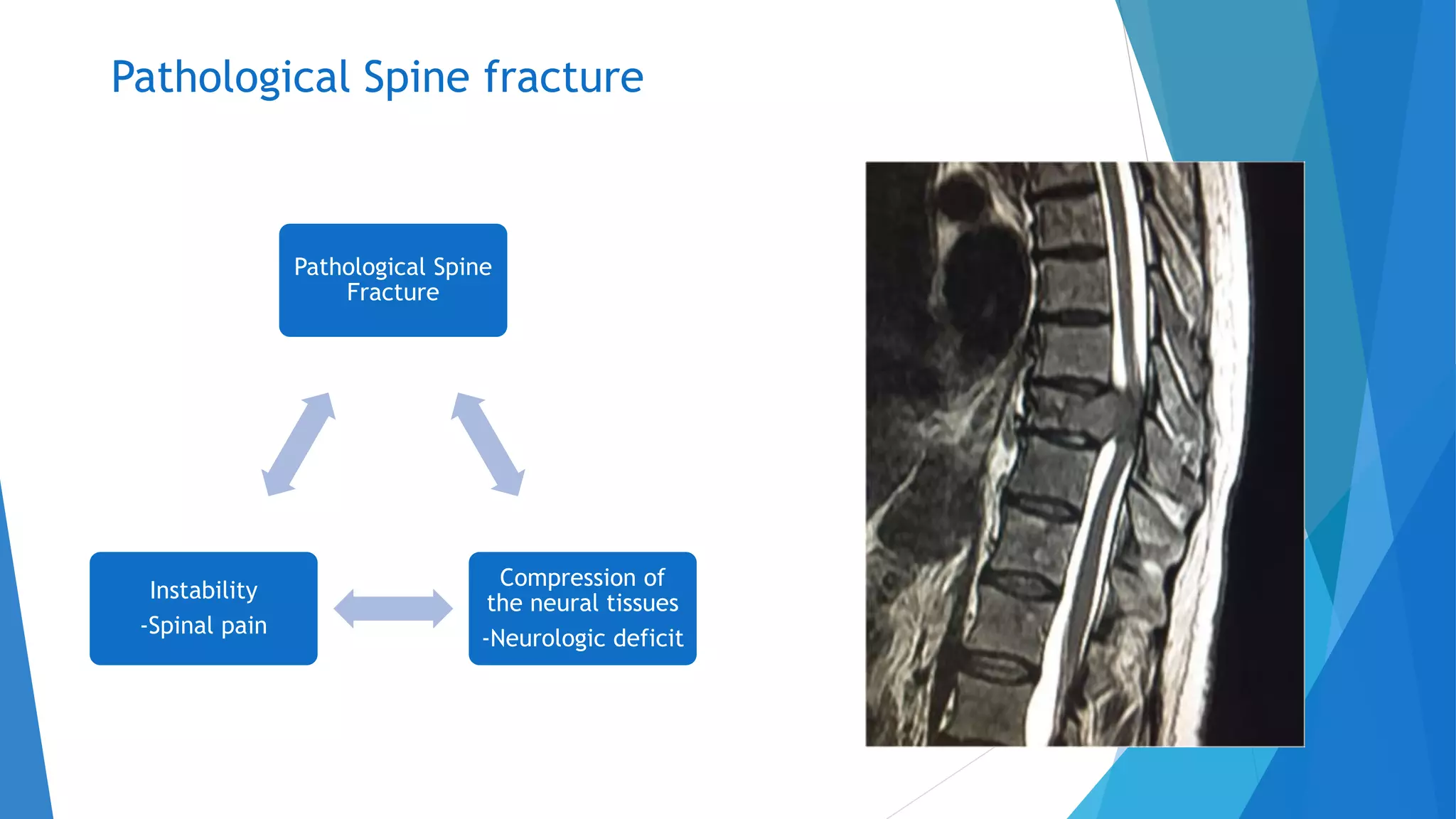 Vertebral Pathologies MANAGEMENT OF VERTEBRAL BODY METASTATIC TUMOURS.pptx