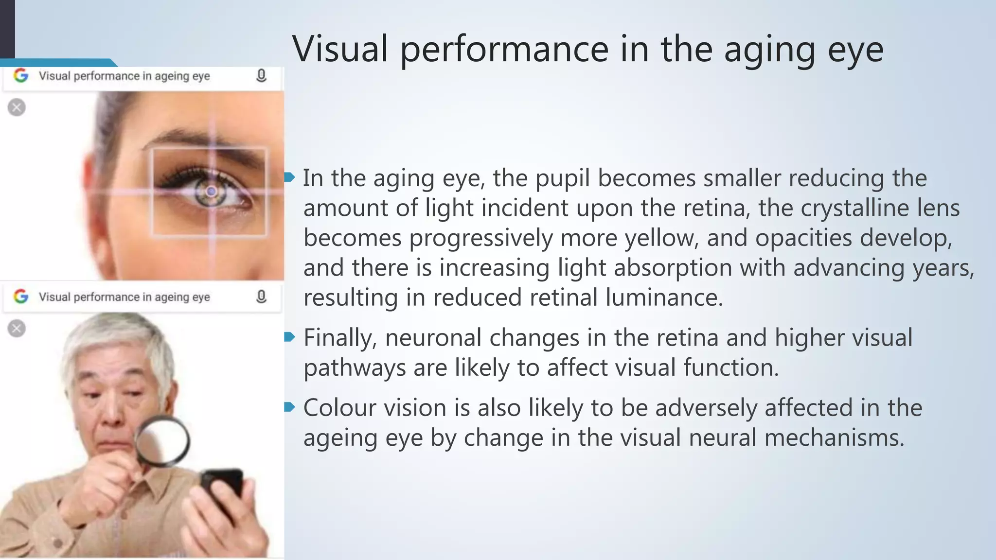 Management of visual problems of Aging by Ashith Tripathi | PPTX