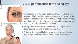 Management of visual problems of Aging by Ashith Tripathi | PPTX | Eye ...