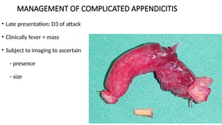 MANAGEMENT OF COMPLICATED APPENDICITIS
• Late presentation: D3 of attack
• Clinically fever + mass
• Subject to imaging to ascertain
- presence
- size
 