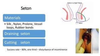 ANO RECTAL DISEASES- MANAGEMENT OPTIONS | PPTX