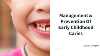 Management &
Prevention Of
Early Childhood
Caries
Sushma GR Mohan
 