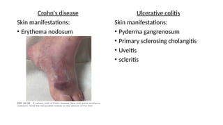 Management principles of inflammatory bowel disease.pptx