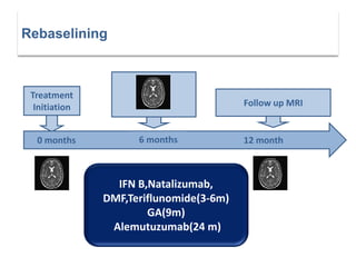 Treatment
Initiation Follow up MRI
0 months 6 months 12 month
Rebaselining
IFN B,Natalizumab,
DMF,Teriflunomide(3-6m)
GA(9m)
Alemutuzumab(24 m)
 