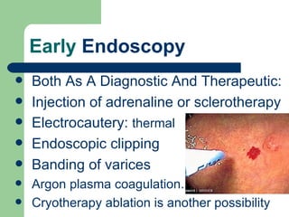 Early  Endoscopy Both As A Diagnostic And Therapeutic:  Injection  of  adrenaline  or  sclerotherapy   Electrocautery:  thermal  Endoscopic clipping  Banding of varices Argon plasma coagulation .  Cryotherapy  ablation is another possibility 